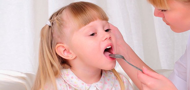 Как лечить трахеит у ребёнка?