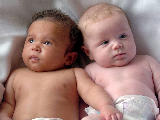Зафиксирован случай рождения близнецов от двух разных отцов 