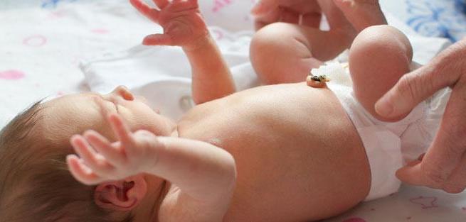 Пупочная ранка у новорождённого: уход и профилактика