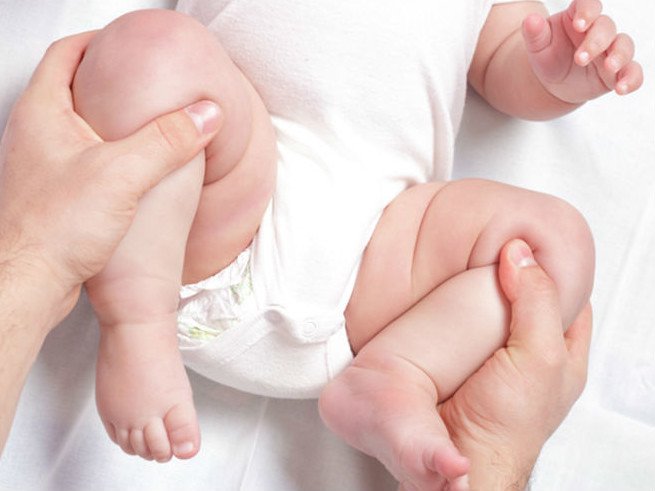 Врожденный подвывих тазобедренного сустава у детей
